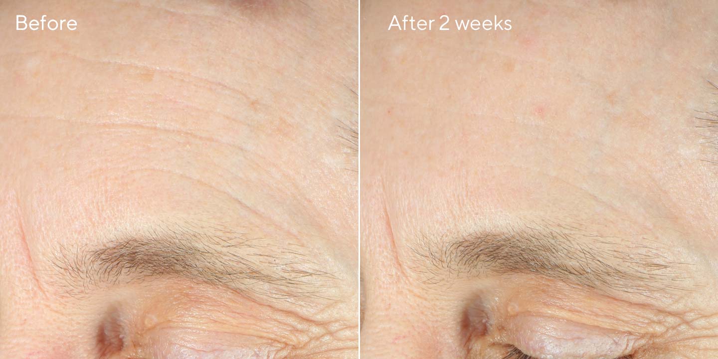 Intense Recovery Cream BnA 1