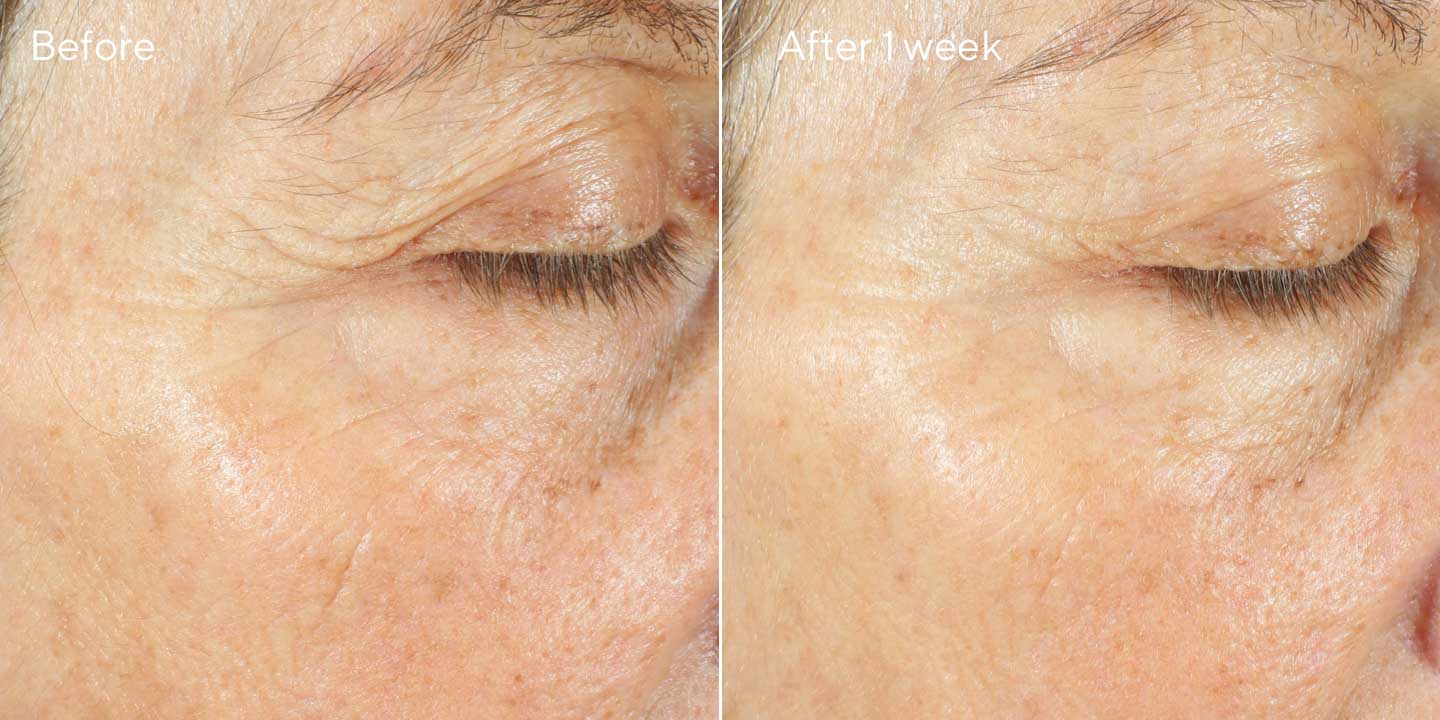 Intense Recovery Cream BnA 3