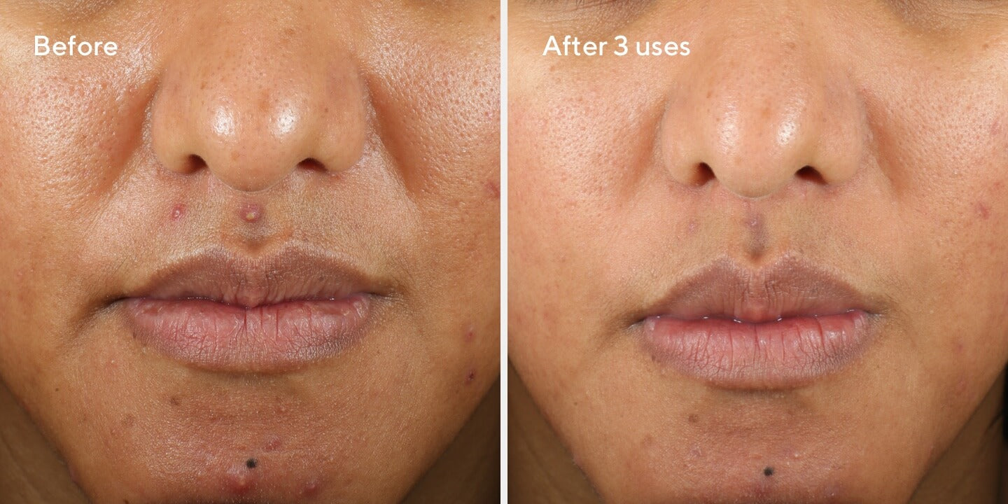 2023 June Rapid Relief Sulfur Mask B&A 1