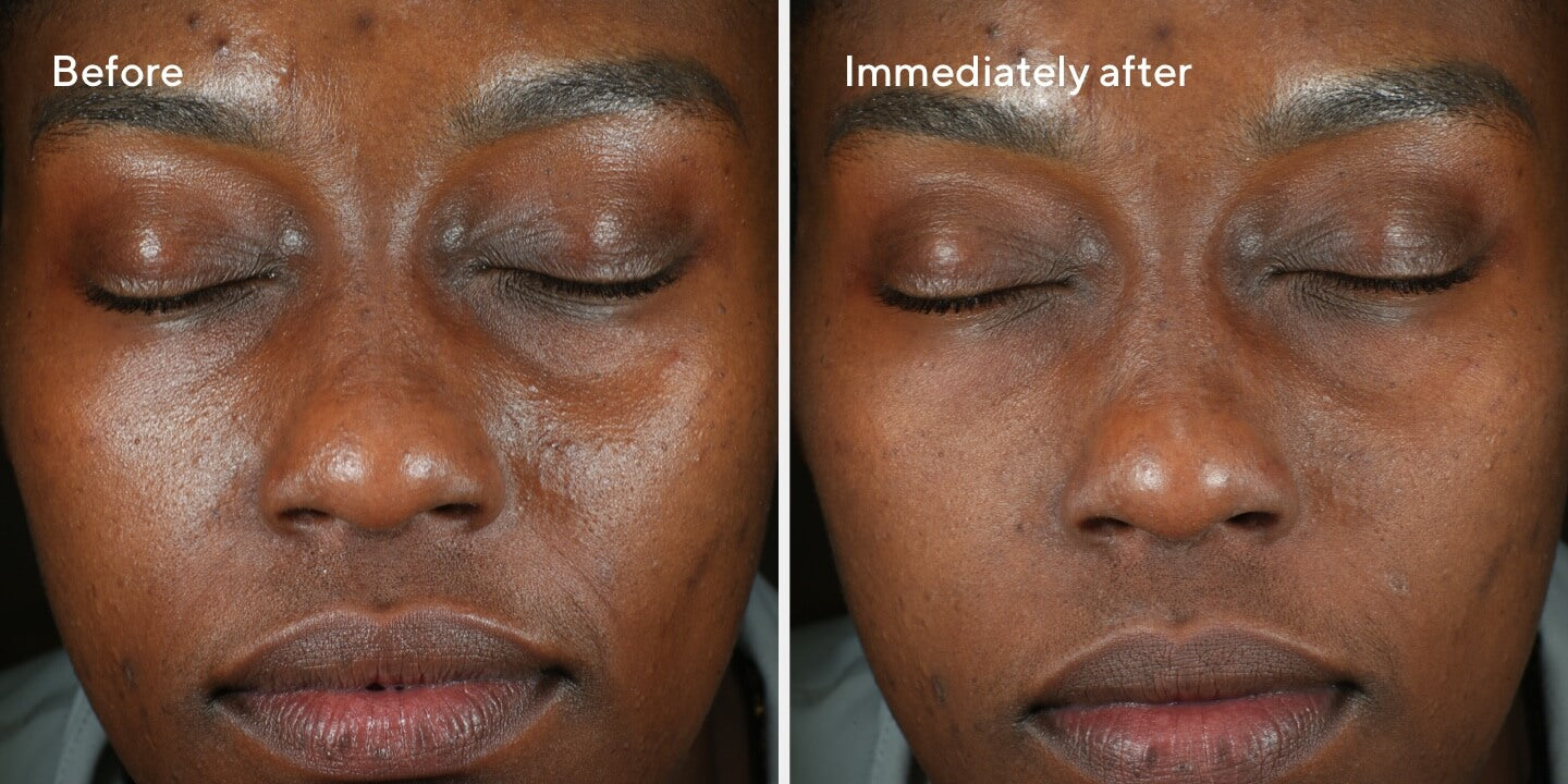 2023 June Rapid Relief Sulfur Mask B&A 2