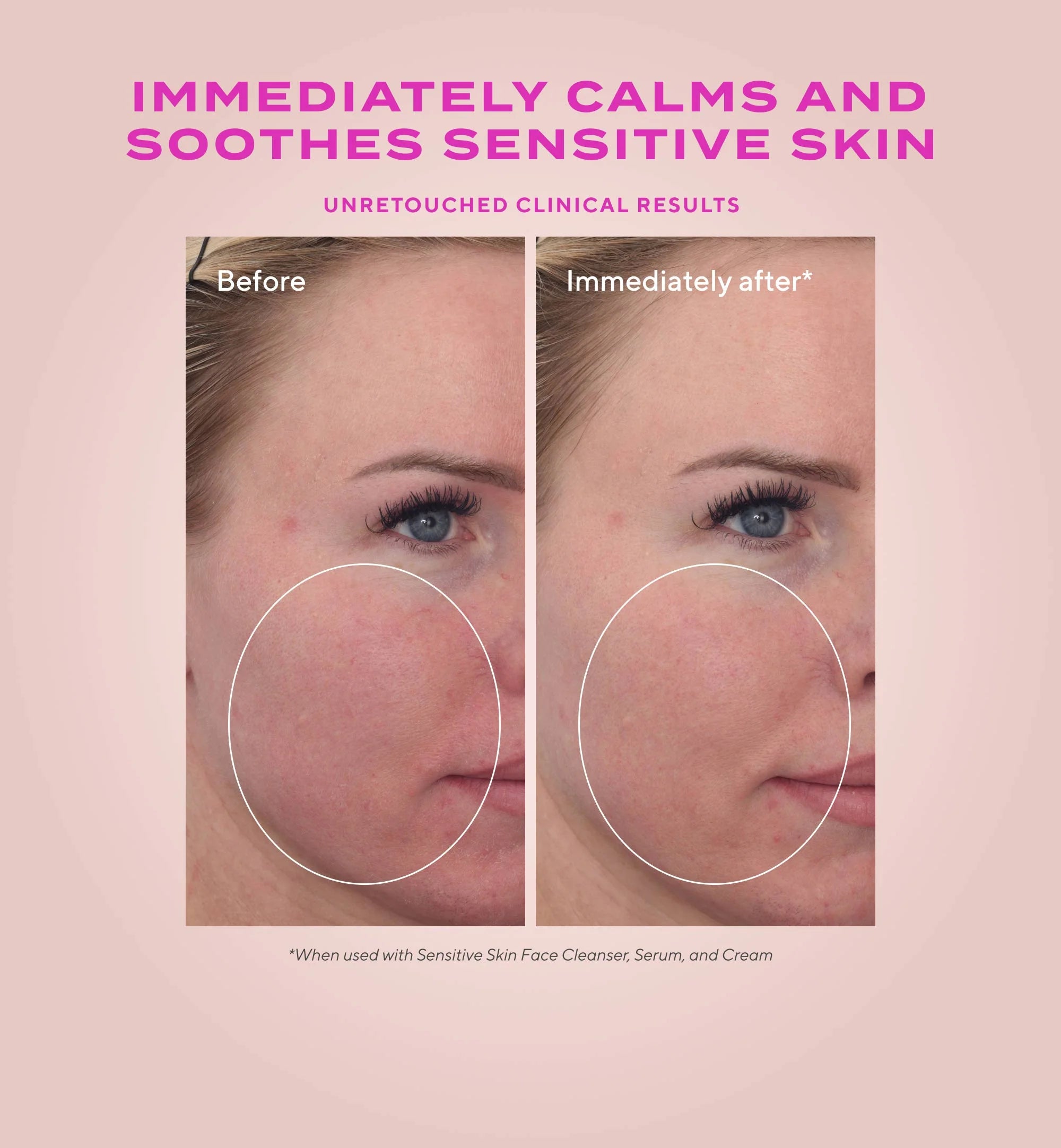 Heartleaf Calming Cream