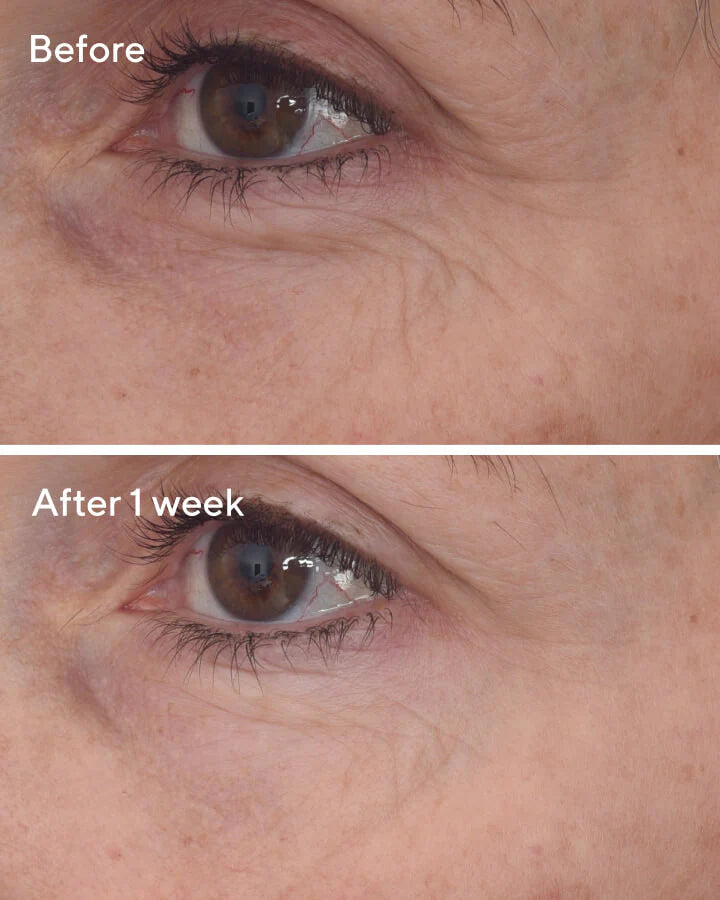 Firming & Lifting Eye Cream Treatment β Murad Skincare Malaysia