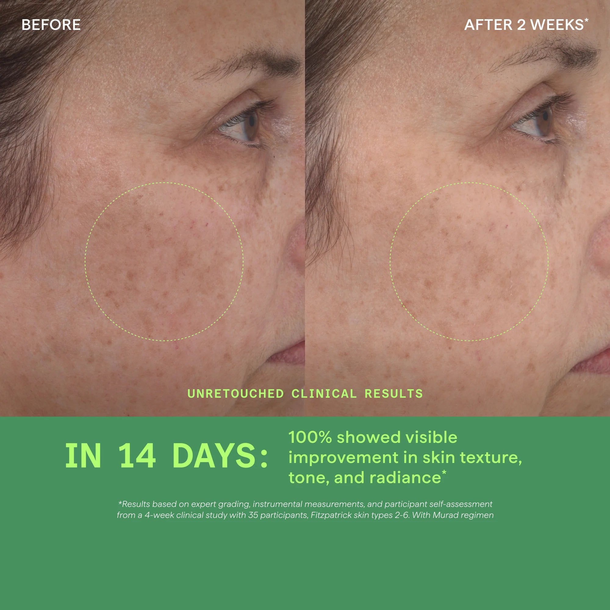 Retinol Youth Renewal Serum