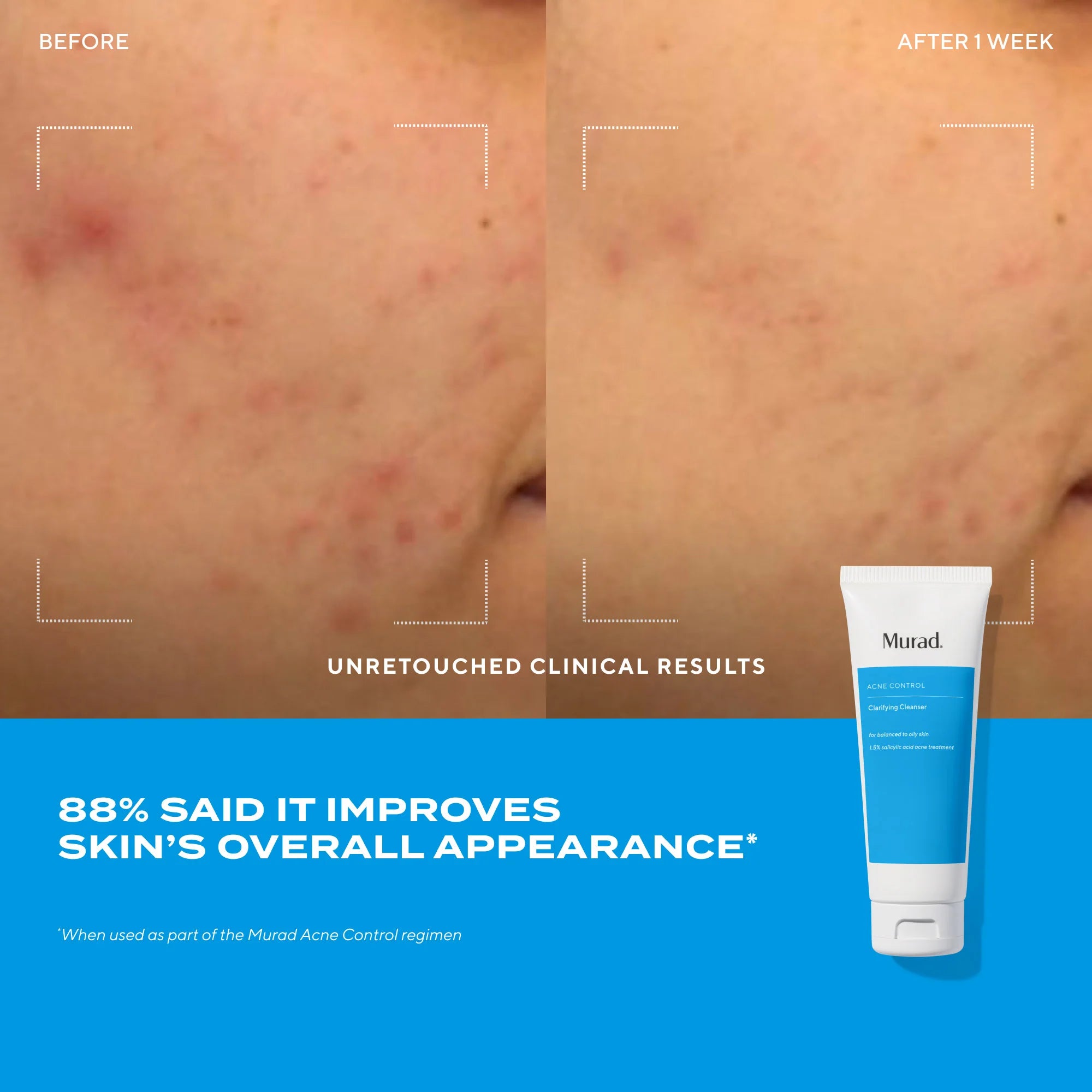 Clarifying Cleanser