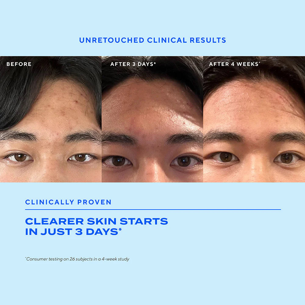 Biome-Balancing Clear & Prevent Blemish Treatment Serum