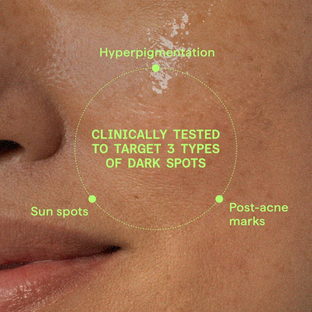 Rapid Dark Spot Correcting Serum